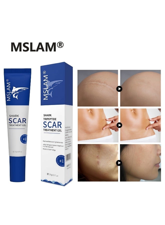 ام اس ال اي ام كريم إم إس إل إيه إم لإزالة الندبات 20 غرام - عناية دقيقة، يُخفي الندبات القديمة والجديدة، ويُعيد للبشرة نعومتها - Image 1